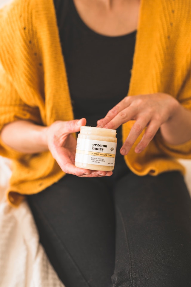 How To Treat Eczema — Without The Help Of Steroids