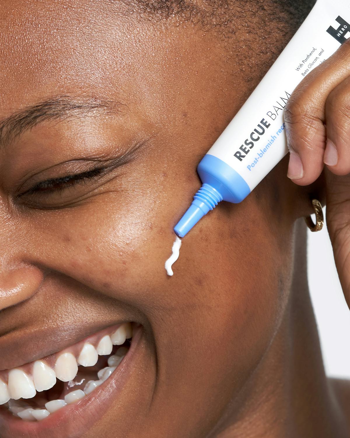 patching blemishes rescue